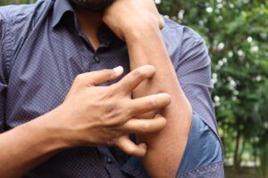 Pacientes de América buscan atención en AlergiaMx: un modelo clínico y académico que cruza fronteras