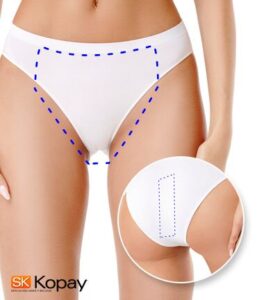 Tecnología YAG Candela facilita depilacion bikini brasileño en Kopay de Gele Giner