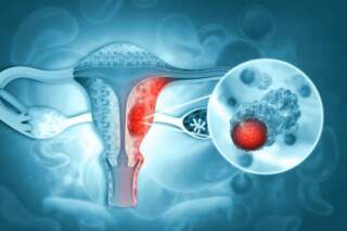 El Cáncer cervicouterino es prevenible en un 99%, pero sigue cobrando miles de vidas. El arte de disfrutar con estilo y sentido.